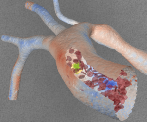 Simulated flow in the human aorta